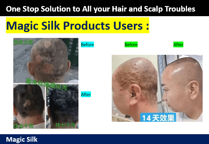 Causes of Scalp Problem