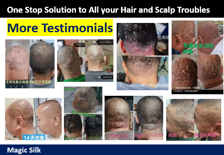 Hair Loss Scalp Problem