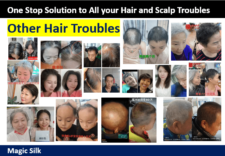 Hair Loss Thinning Hair Problem