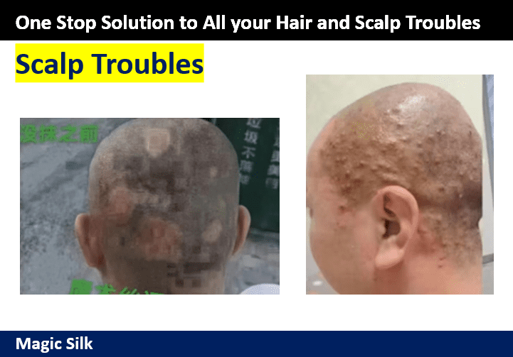 Scalp Problem